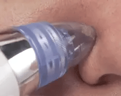 Limpiador puntos Negros Cleaner