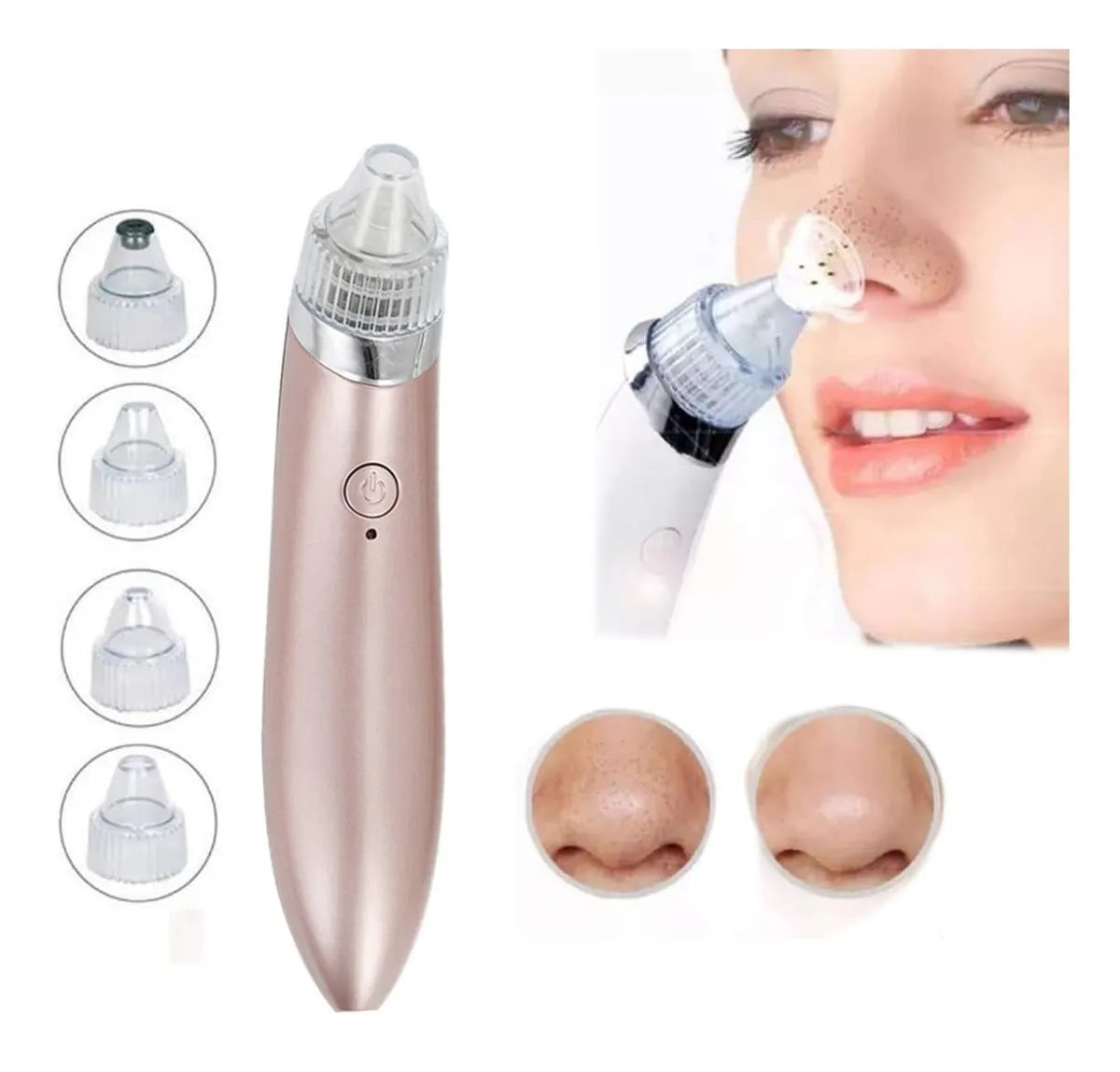 Limpiador puntos Negros Cleaner