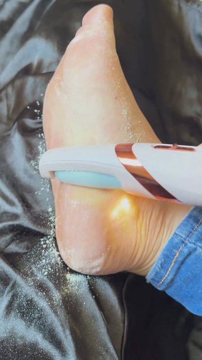 🦶✨DermaLux - Removedor De Callos Recargable